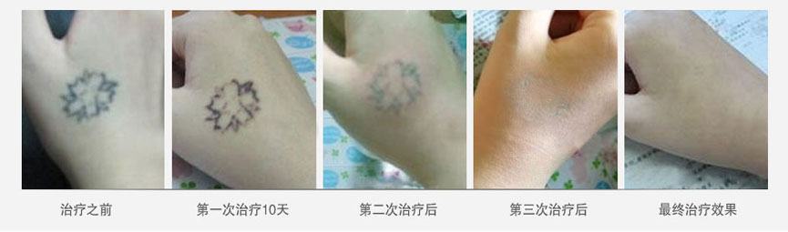 纹身个人形象受到影响